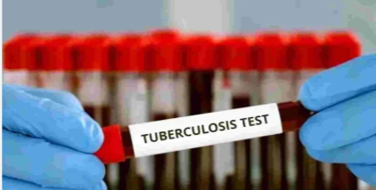 Made-in-India TB tests validated by ICMR; offer cheaper, faster detection